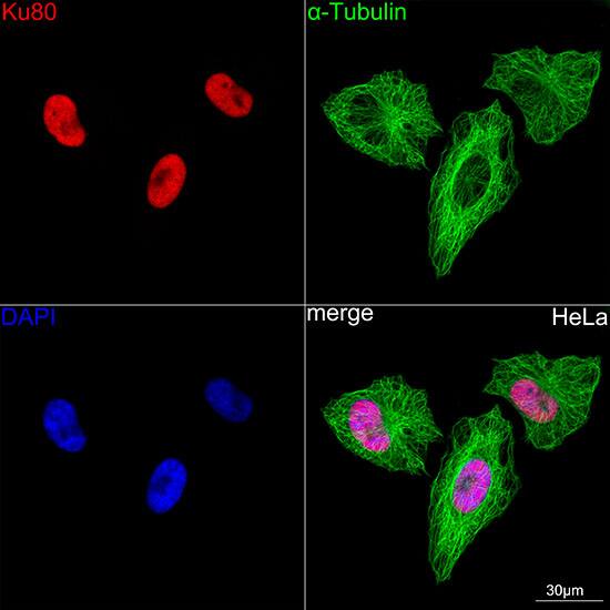 Immunocytochemistry/ Immunofluorescence: Ku80/XRCC5 Antibody (7N7G3) [Ku80/XRCC5] - Confocal imaging of HeLa cells using Ku80/XRCC5 Rabbit mAb . The cells were counterstained with alpha-Tubulin Mouse mAb  (Green). DAPI was used for nuclear staining (blue). Objective: 60x.