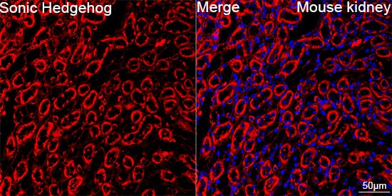 Immunocytochemistry/ Immunofluorescence: Sonic Hedgehog/Shh Antibody (8T4D3) [Sonic Hedgehog/Shh] - Confocal imaging of paraffin-embedded Mouse kidney using Sonic Hedgehog/Shh Rabbit mAb  followed by a further incubation with Cy3 Goat Anti-Rabbit IgG (H+L)  . DAPI was used for nuclear staining (Blue). Objective: 40x. Perform high pressure antigen retrieval with 0.01 M citrate buffer (pH 6.0) prior to IF staining.