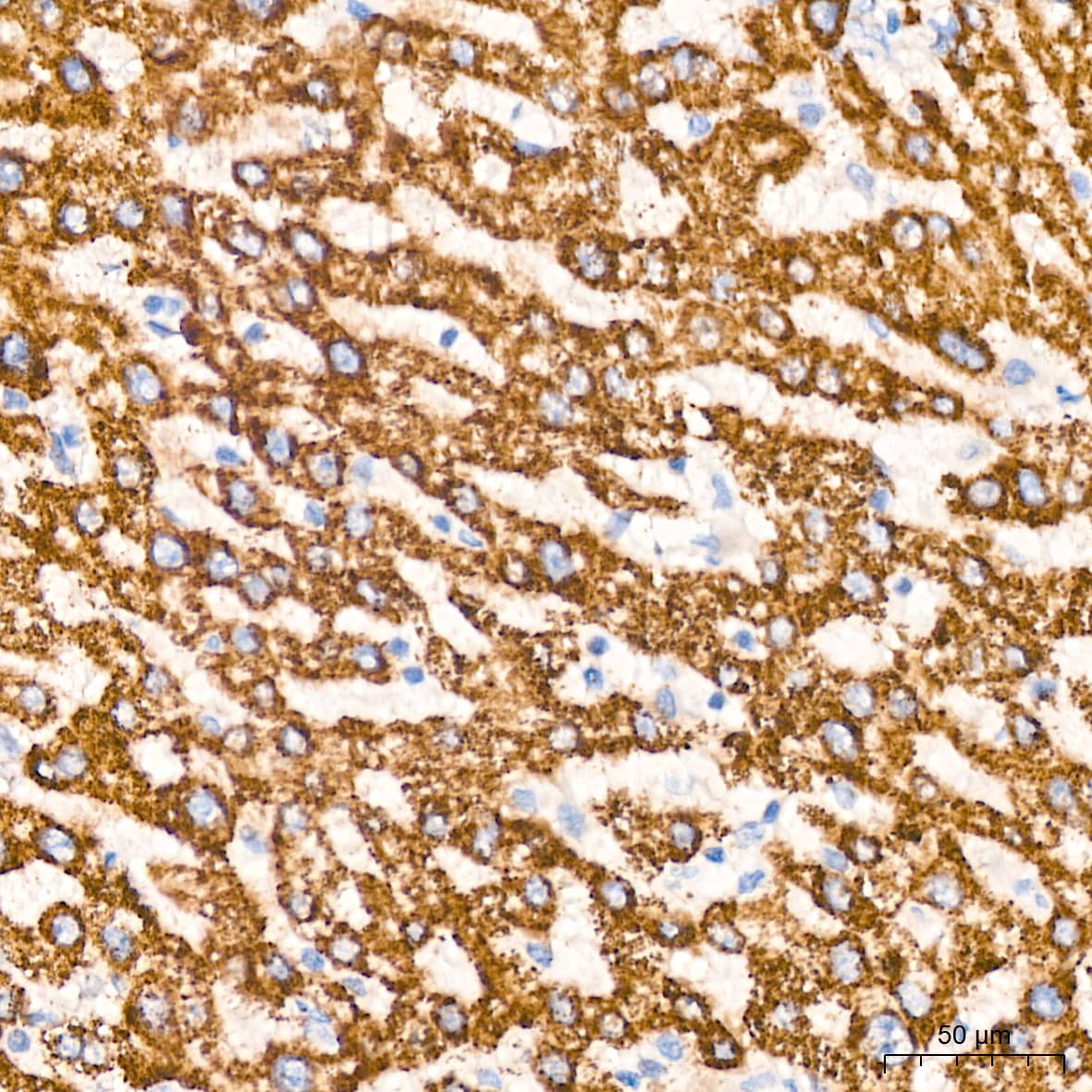 Immunohistochemistry: TIMM50 Antibody (0W6J4) [NBP3-15459] - Immunohistochemistry analysis of TIMM50 in paraffin-embedded human liver tissue using TIMM50 Rabbit mAb  at a dilution of 1:200 (40x lens). High pressure antigen retrieval was performed with 0.01 M Tris-EDTA buffer (pH 9.0) prior to IHC staining.