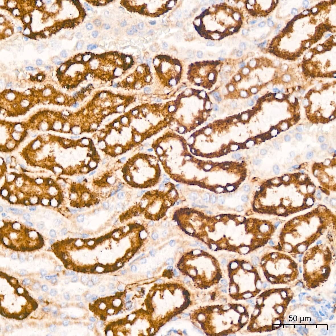 Immunohistochemistry: TIMM50 Antibody (0W6J4) [NBP3-15459] - Immunohistochemistry analysis of TIMM50 in paraffin-embedded mouse kidney tissue using TIMM50 Rabbit mAb  at a dilution of 1:200 (40x lens). High pressure antigen retrieval was performed with 0.01 M Tris-EDTA buffer (pH 9.0) prior to IHC staining.