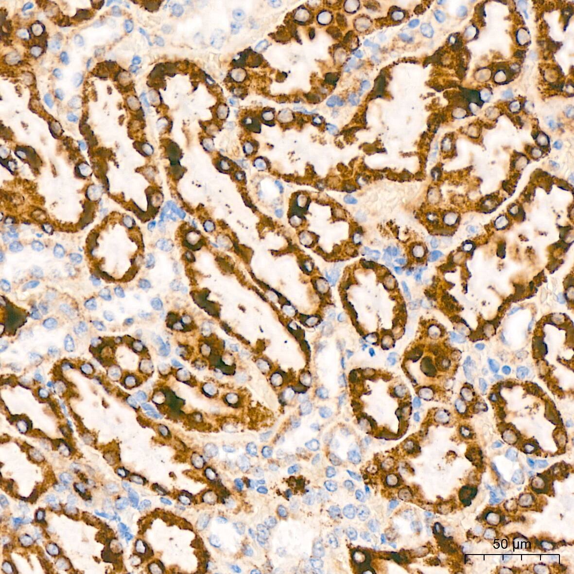 Immunohistochemistry: TIMM50 Antibody (0W6J4) [NBP3-15459] - Immunohistochemistry analysis of TIMM50 in paraffin-embedded rat kidney tissue using TIMM50 Rabbit mAb  at a dilution of 1:200 (40x lens). High pressure antigen retrieval was performed with 0.01 M Tris-EDTA buffer (pH 9.0) prior to IHC staining.