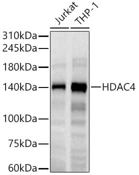 Western Blot: Histone Deacetylase 4/HDAC4 Antibody (9A6E2) [NBP3-15463] - Western blot analysis of various lysates, using Histone Deacetylase 4/HDAC4 antibody  at 1:500 dilution.Secondary antibody: HRP Goat Anti-Rabbit IgG (H+L)  at 1:10000 dilution.Lysates/proteins: 25ug per lane.Blocking buffer: 3% nonfat dry milk in TBST.Detection: ECL Basic Kit .Exposure time: 60s.