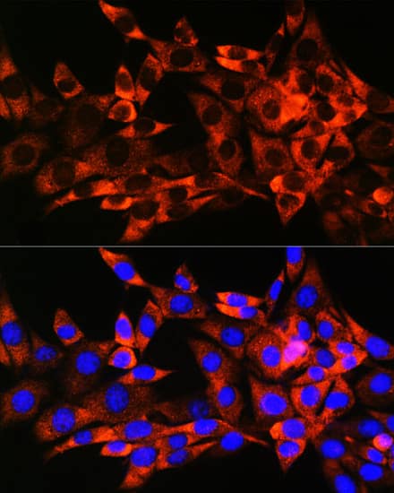 Immunocytochemistry/ Immunofluorescence: HSPB8/HSP22 Antibody (3K10W1) [NBP3-15464] - Immunofluorescence analysis of NIH-3T3 cells using HSPB8/HSP22 Rabbit mAb  at dilution of 1:100 (40x lens). Blue: DAPI for nuclear staining.