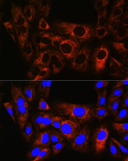 Immunocytochemistry/ Immunofluorescence: HSPB8/HSP22 Antibody (3K10W1) [NBP3-15464] - Immunofluorescence analysis of U-2 OS cells using HSPB8/HSP22 Rabbit mAb  at dilution of 1:100 (40x lens). Blue: DAPI for nuclear staining.