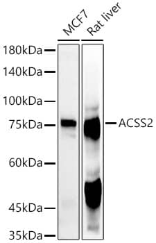 Western Blot: Acetyl CoA synthetase Antibody - BSA Free [NBP3-15466] - Western blot analysis of extracts of various cell lines, using Acetyl CoA synthetase antibody  at  1:1000 dilution.Secondary antibody: HRP Goat Anti-Rabbit IgG (H+L)  at 1:10000 dilution.Lysates/proteins: 25ug per lane.Blocking buffer: 3% nonfat dry milk in TBST.Detection: ECL Basic Kit .Exposure time: 10s.