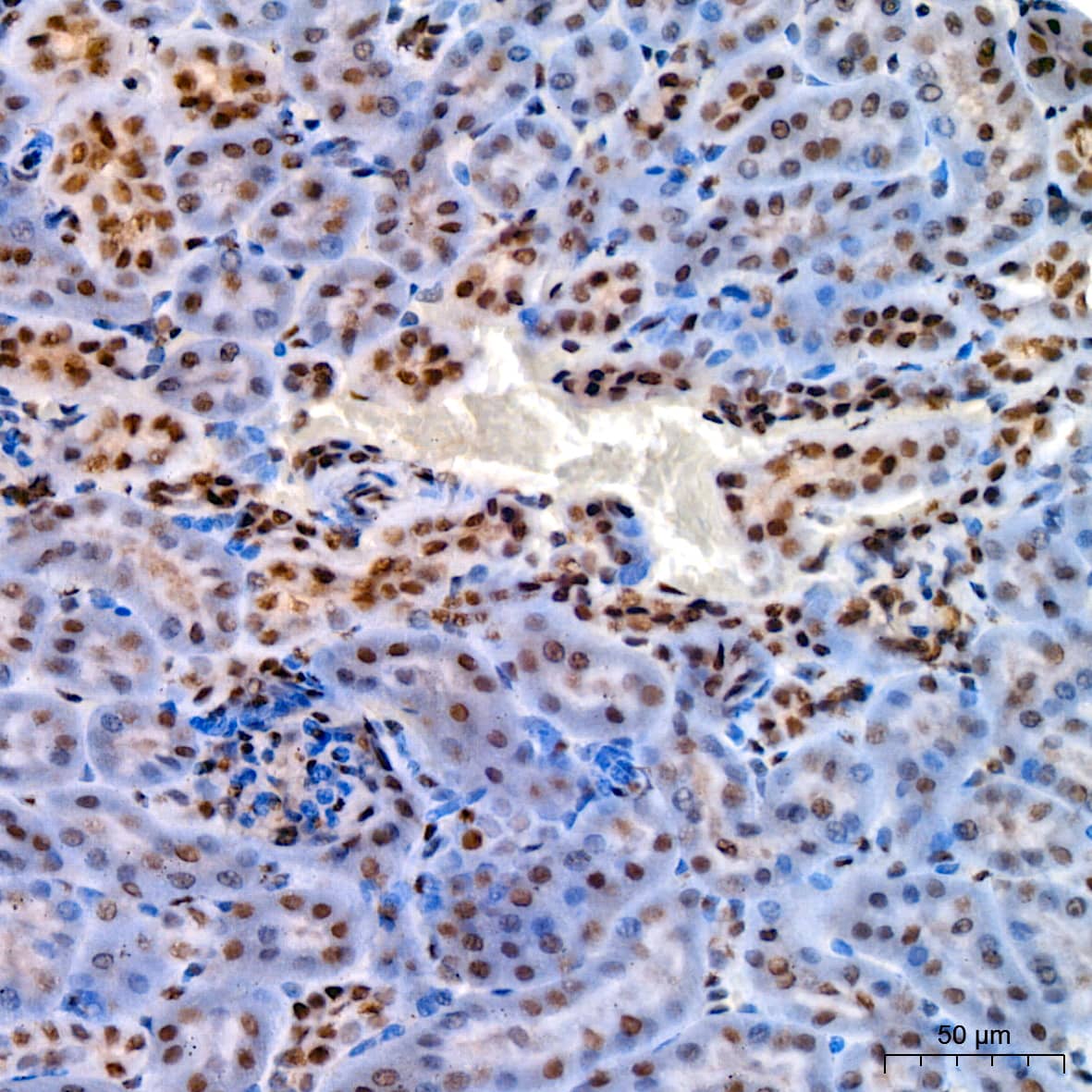 Immunohistochemistry: KLF4 Antibody (7B7U1) [KLF4] - Immunohistochemistry analysis of paraffin-embedded Mouse kidney using KLF4 Rabbit mAb  at dilution of 1:200 (40x lens). High pressure antigen retrieval performed with 0.01M Citrate Bufferr (pH 6.0) prior to IHC staining.