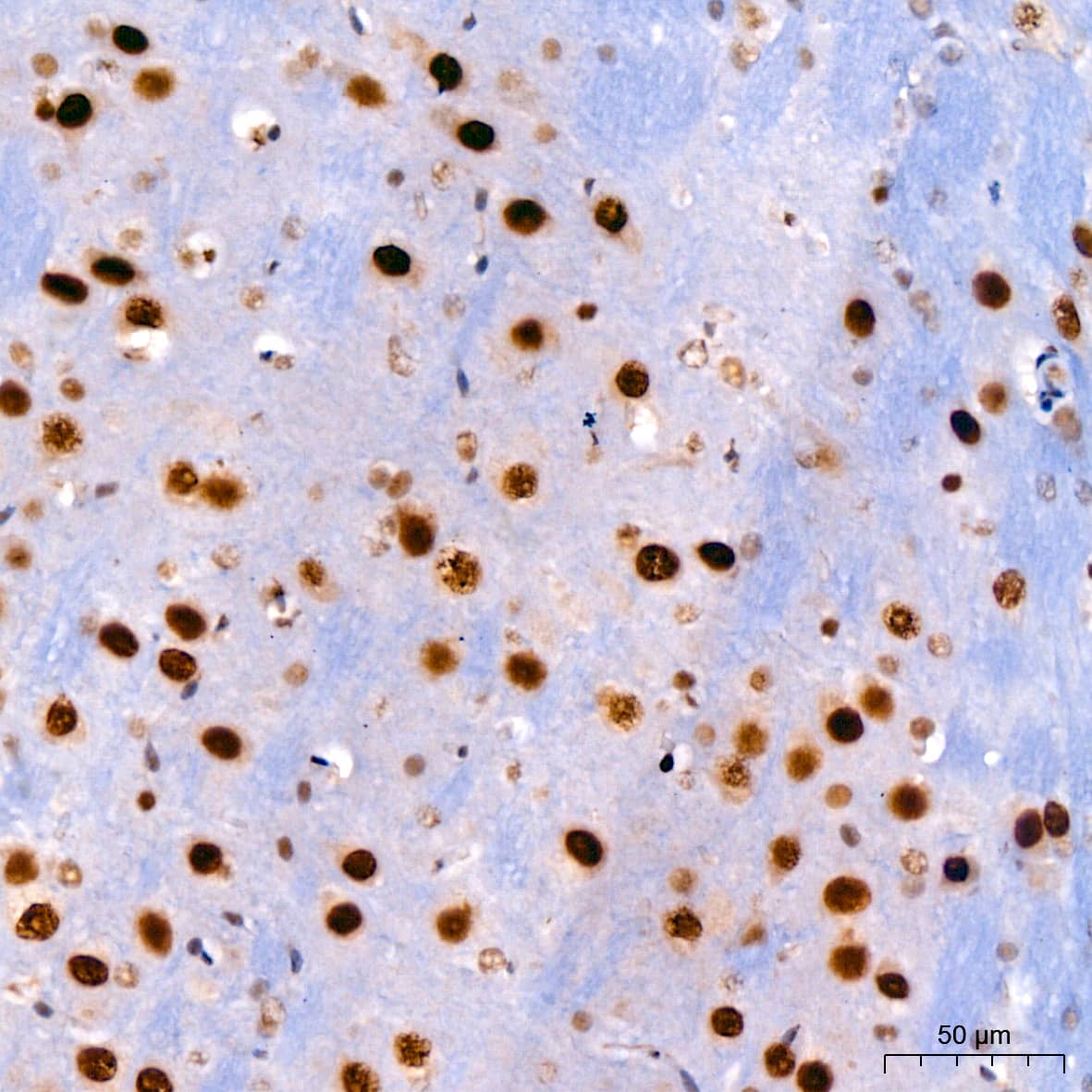 Immunohistochemistry: KLF4 Antibody (7B7U1) [KLF4] - Immunohistochemistry analysis of paraffin-embedded Mouse brain using KLF4 Rabbit mAb  at dilution of 1:200 (40x lens). High pressure antigen retrieval performed with 0.01M Citrate Bufferr (pH 6.0) prior to IHC staining.