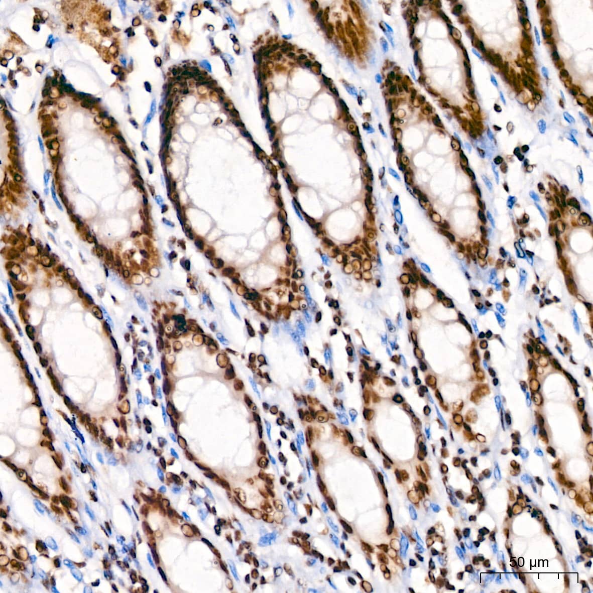 Immunohistochemistry: KLF4 Antibody (7B7U1) [KLF4] - Immunohistochemistry analysis of paraffin-embedded Human colon using KLF4 Rabbit mAb  at dilution of 1:200 (40x lens). High pressure antigen retrieval performed with 0.01M Citrate Bufferr (pH 6.0) prior to IHC staining.