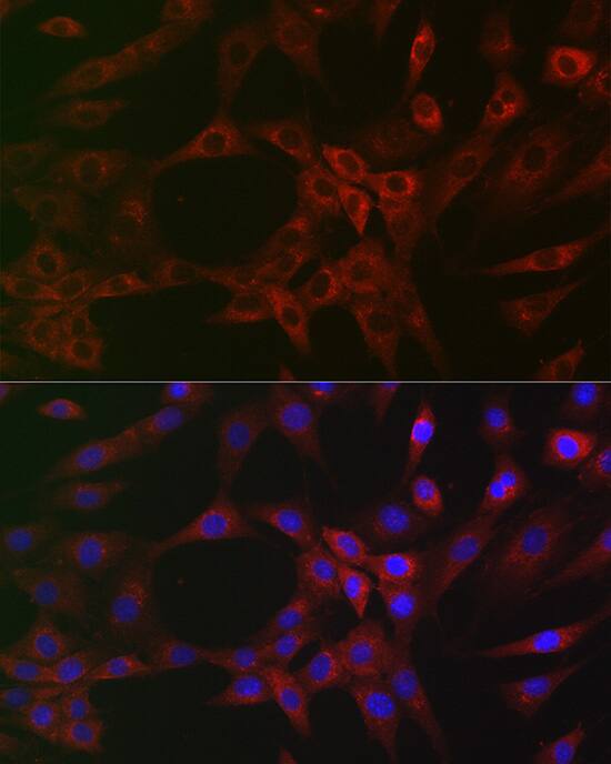 Immunocytochemistry/ Immunofluorescence: ARPC2 Antibody (4F2G6) [NBP3-15471] - Immunofluorescence analysis of NIH/3T3 cells using ARPC2 Rabbit mAb  at dilution of 1:100 (40x lens). Secondary antibody: Cy3 Goat Anti-Rabbit IgG (H+L)  at 1:500 dilution. Blue: DAPI for nuclear staining.