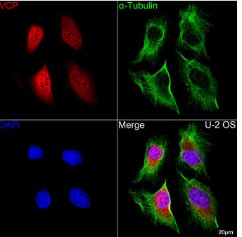 Immunocytochemistry/Immunofluorescence: p97/VCP Antibody (3P8T3) [NBP3-15478] - Confocal imaging of U-2 OS cells using VCP Rabbit mAb (dilution 1:200) followed by a further incubation with Cy3 Goat Anti-Rabbit IgG (H+L) (dilution 1:500) (Red). The cells were counterstained with  alpha -Tubulin Mouse mAb (dilution 1:400) followed by incubation with ABflo® 488-conjugated Goat Anti-Mouse IgG (H+L) Ab (dilution 1:500) (Green). DAPI was used for nuclear staining (Blue). Objective: 100x.