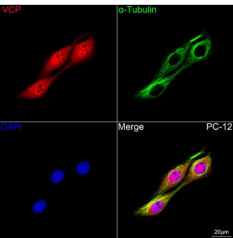 Immunocytochemistry/Immunofluorescence: p97/VCP Antibody (3P8T3) [NBP3-15478] -Confocal imaging of PC-12 cells using VCP Rabbit mAb (dilution 1:200) followed by a further incubation with Cy3 Goat Anti-Rabbit IgG (H+L) (dilution 1:500) (Red). The cells were counterstained with  alpha -Tubulin Mouse mAb (dilution 1:400) followed by incubation with ABflo® 488-conjugated Goat Anti-Mouse IgG (H+L) Ab (dilution 1:500) (Green). DAPI was used for nuclear staining (Blue). Objective: 100x.