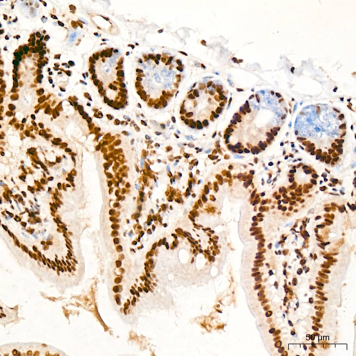 Immunohistochemistry: PDCD7 Antibody (8A1Q3) [NBP3-15482] - Immunohistochemistry analysis of PDCD7 in paraffin-embedded mouse intestin tissue using PDCD7 Rabbit mAb  at a dilution of 1:200 (40x lens). High pressure antigen retrieval was performed with 0.01 M citrate buffer (pH 6.0) prior to IHC staining.