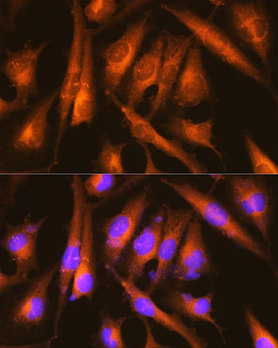 Immunocytochemistry/ Immunofluorescence: Huntingtin Antibody - Azide and BSA Free [Huntingtin] - Immunofluorescence analysis of U-251MG cells using Huntingtin Rabbit pAb  at dilution of 1:100 (40x lens). Secondary antibody: Cy3 Goat Anti-Rabbit IgG (H+L)  at 1:500 dilution. Blue: DAPI for nuclear staining.