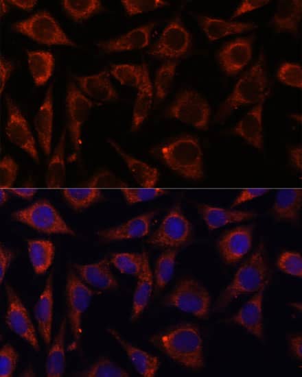 Immunocytochemistry/ Immunofluorescence: MRPS7 Antibody - Azide and BSA Free [NBP3-15524] - Immunofluorescence analysis of L929 cells using MRPS7 Rabbit pAb  at dilution of 1:100. Secondary antibody: Cy3 Goat Anti-Rabbit IgG (H+L)  at 1:500 dilution. Blue: DAPI for nuclear staining.