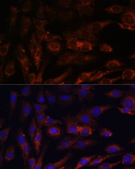 Immunocytochemistry/ Immunofluorescence: MRPS7 Antibody - Azide and BSA Free [NBP3-15524] - Immunofluorescence analysis of C6 cells using MRPS7 Rabbit pAb  at dilution of 1:100. Secondary antibody: Cy3 Goat Anti-Rabbit IgG (H+L)  at 1:500 dilution. Blue: DAPI for nuclear staining.