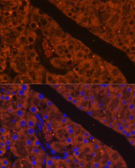 Immunocytochemistry/ Immunofluorescence ELA2A Antibody - Azide and BSA Free