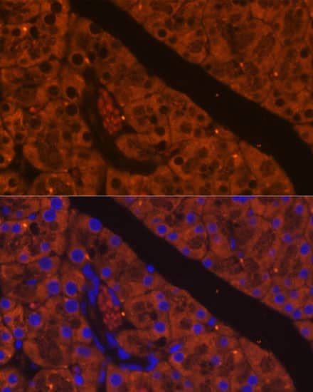 Immunocytochemistry/ Immunofluorescence ELA2A Antibody - Azide and BSA Free