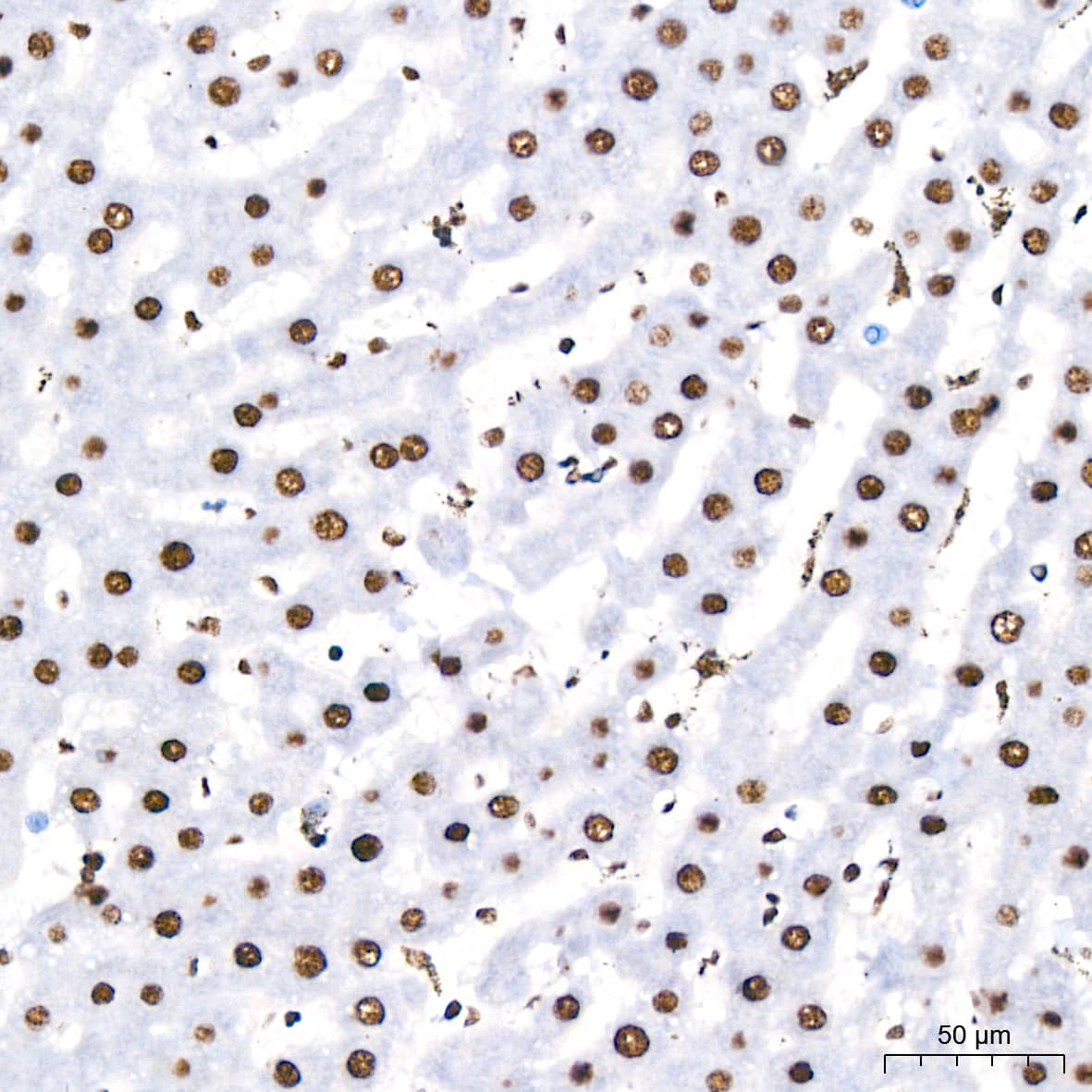 Immunohistochemistry: PABPN1 Antibody (7V4X8) [PABPN1] - Immunohistochemistry analysis of paraffin-embedded Rat liver tissue using PABPN1 Rabbit mAb  at a dilution of 1:200 (40x lens). High pressure antigen retrieval performed with 0.01M Citrate Bufferr (pH 6.0) prior to IHC staining.