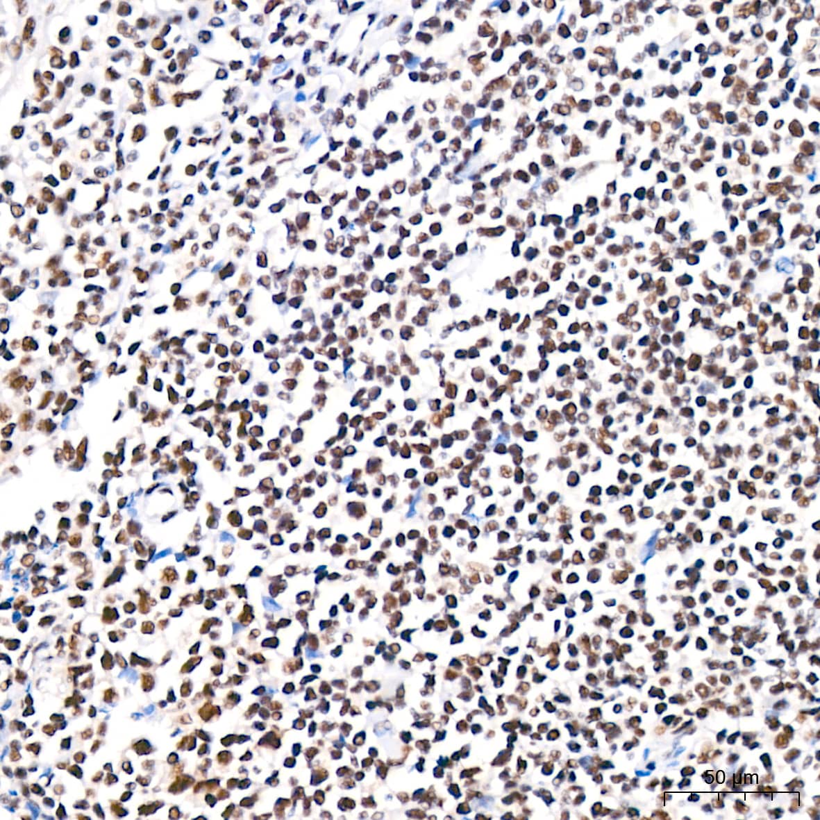 Immunohistochemistry: PABPN1 Antibody (7V4X8) [PABPN1] - Immunohistochemistry analysis of paraffin-embedded Human tonsil tissue using PABPN1 Rabbit mAb  at a dilution of 1:200 (40x lens). High pressure antigen retrieval performed with 0.01M Citrate Bufferr (pH 6.0) prior to IHC staining.