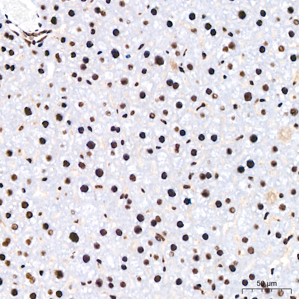 Immunohistochemistry: PABPN1 Antibody (7V4X8) [PABPN1] - Immunohistochemistry analysis of paraffin-embedded Mouse liver tissue using PABPN1 Rabbit mAb  at a dilution of 1:200 (40x lens). High pressure antigen retrieval performed with 0.01M Citrate Bufferr (pH 6.0) prior to IHC staining.