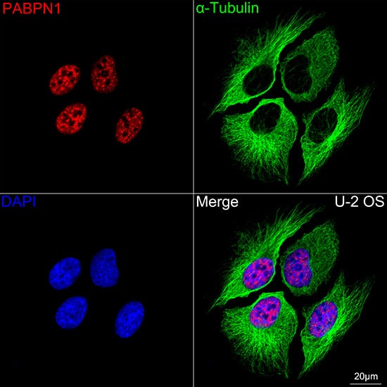 Immunocytochemistry/ Immunofluorescence: PABPN1 Antibody (7V4X8) [PABPN1] - Confocal imaging of U-2 OS cells  using PABPN1 Rabbit mAb   followed by a further incubation with Cy3 Goat Anti-Rabbit IgG (H+L) .The cells were counterstained with alpha-Tubulin Mouse mAb  followed by incubation with ABflo 488-conjugated Goat Anti-Mouse IgG (H+L) Ab  (Green).DAPI was used for nuclear staining (Blue). Objective: 100x.