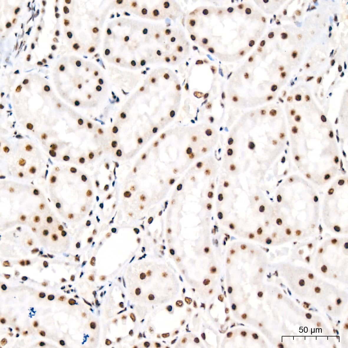 Immunohistochemistry: PABPN1 Antibody (7V4X8) [PABPN1] - Immunohistochemistry analysis of paraffin-embedded Rat kidney tissue using PABPN1 Rabbit mAb  at a dilution of 1:200 (40x lens). High pressure antigen retrieval performed with 0.01M Citrate Bufferr (pH 6.0) prior to IHC staining.