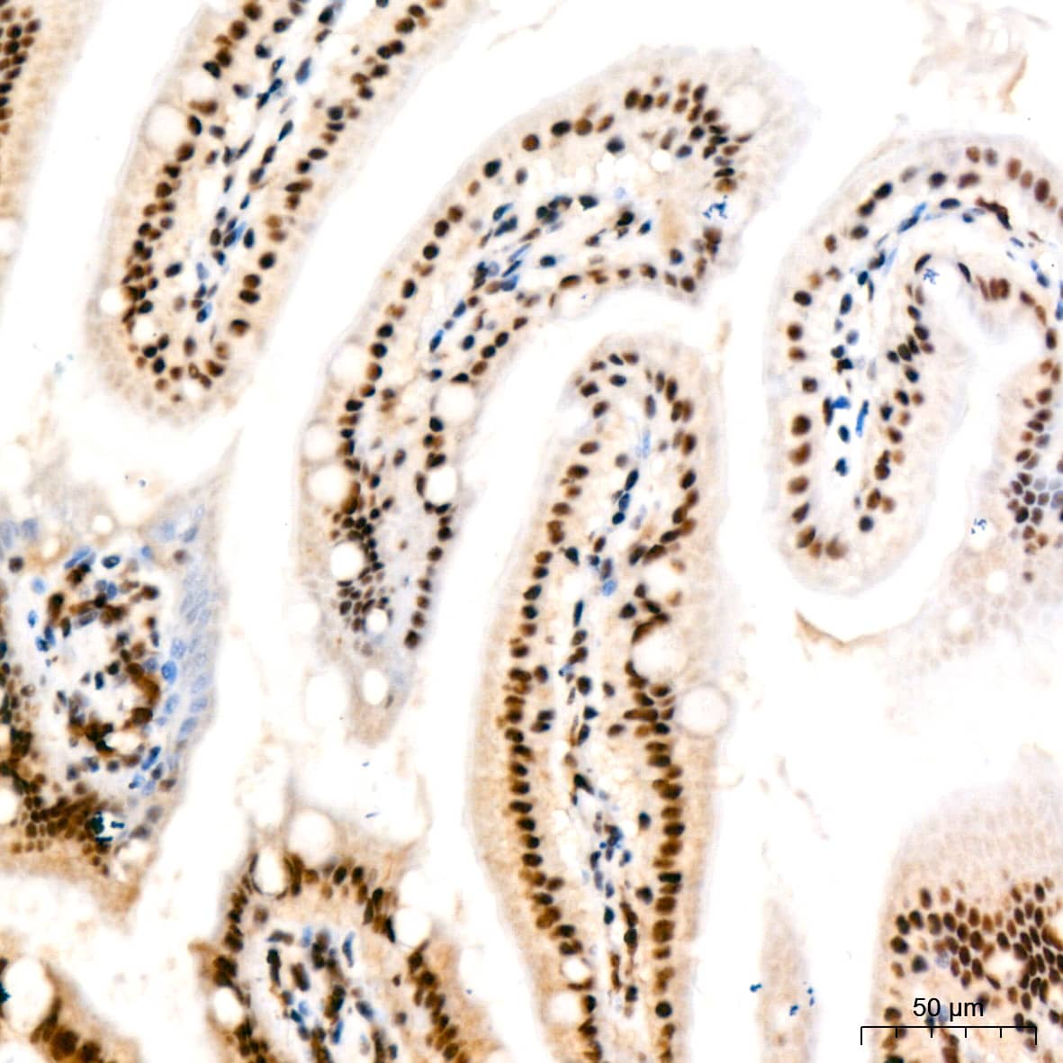 Immunohistochemistry: PABPN1 Antibody (7V4X8) [PABPN1] - Immunohistochemistry analysis of paraffin-embedded Mouse intestin tissue using PABPN1 Rabbit mAb  at a dilution of 1:200 (40x lens). High pressure antigen retrieval performed with 0.01M Citrate Bufferr (pH 6.0) prior to IHC staining.