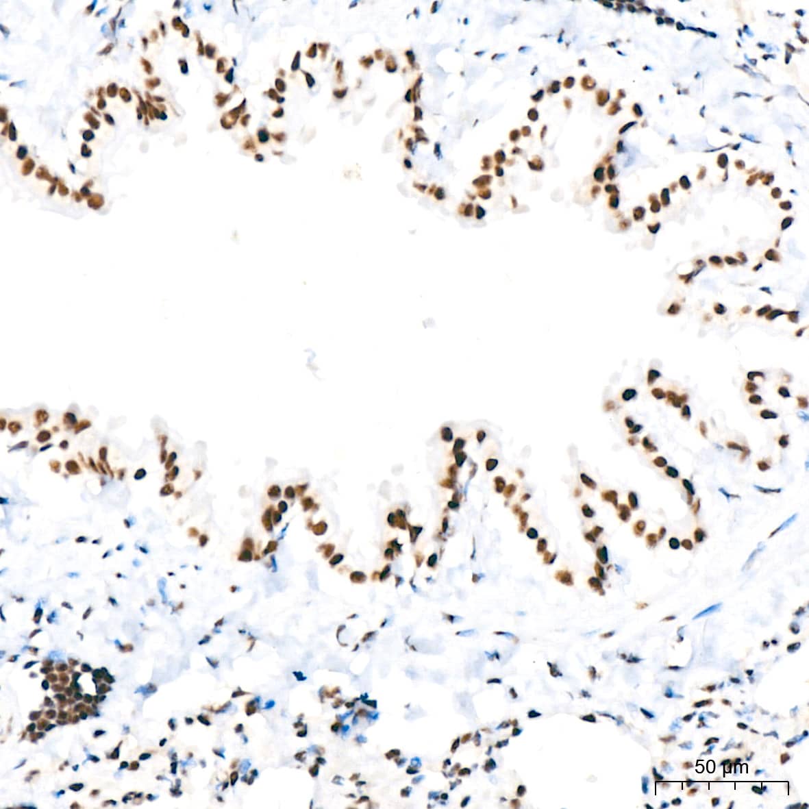 Immunohistochemistry: PABPN1 Antibody (7V4X8) [PABPN1] - Immunohistochemistry analysis of paraffin-embedded Rat lung tissue using PABPN1 Rabbit mAb  at a dilution of 1:200 (40x lens). High pressure antigen retrieval performed with 0.01M Citrate Bufferr (pH 6.0) prior to IHC staining.