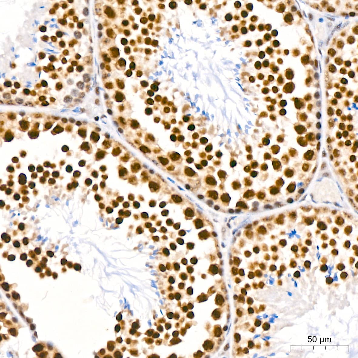 Immunohistochemistry: PABPN1 Antibody (7V4X8) [PABPN1] - Immunohistochemistry analysis of paraffin-embedded Mouse testis tissue using PABPN1 Rabbit mAb  at a dilution of 1:200 (40x lens). High pressure antigen retrieval performed with 0.01M Citrate Bufferr (pH 6.0) prior to IHC staining.