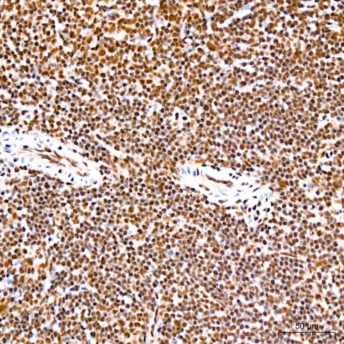 Immunohistochemistry: PABPN1 Antibody (7V4X8) [PABPN1] - Immunohistochemistry analysis of paraffin-embedded Mouse spleen tissue using PABPN1 Rabbit mAb  at a dilution of 1:200 (40x lens). High pressure antigen retrieval performed with 0.01M Citrate Bufferr (pH 6.0) prior to IHC staining.