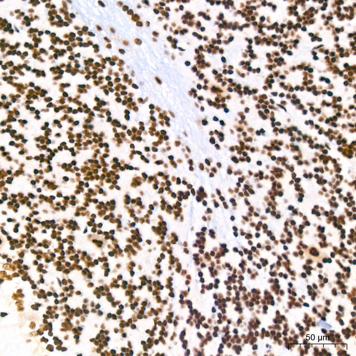 Immunohistochemistry: PABPN1 Antibody (7V4X8) [PABPN1] - Immunohistochemistry analysis of paraffin-embedded Rat brain tissue using PABPN1 Rabbit mAb  at a dilution of 1:200 (40x lens). High pressure antigen retrieval performed with 0.01M Citrate Bufferr (pH 6.0) prior to IHC staining.