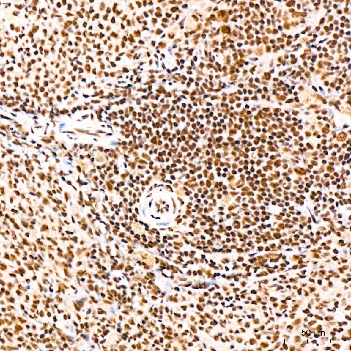 Immunohistochemistry: PABPN1 Antibody (7V4X8) [PABPN1] - Immunohistochemistry analysis of paraffin-embedded Rat spleen tissue using PABPN1 Rabbit mAb  at a dilution of 1:200 (40x lens). High pressure antigen retrieval performed with 0.01M Citrate Bufferr (pH 6.0) prior to IHC staining.