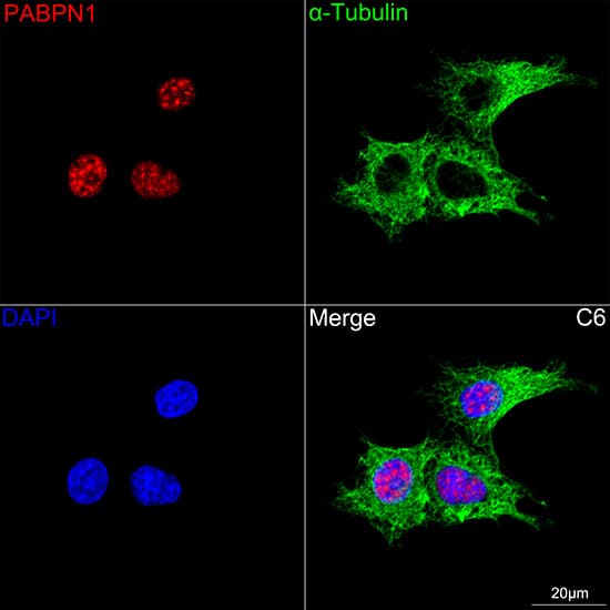 Immunocytochemistry/ Immunofluorescence PABPN1 Antibody (7V4X8)