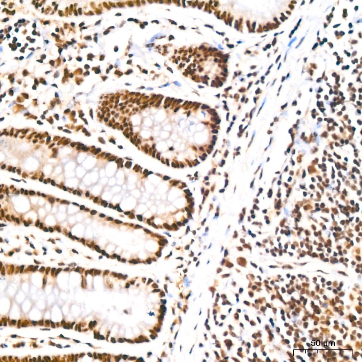 Immunohistochemistry PABPN1 Antibody (7V4X8)