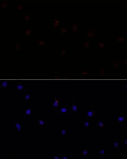 Immunocytochemistry/ Immunofluorescence Calpain 7 Antibody - Azide and BSA Free