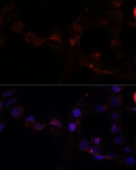 Immunocytochemistry/ Immunofluorescence Calpain 7 Antibody - Azide and BSA Free