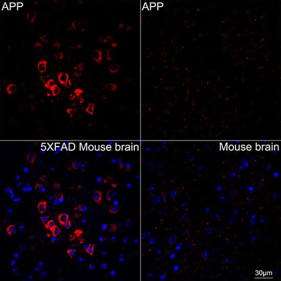 Immunocytochemistry/ Immunofluorescence: APP Antibody (3A8S2) [APP] - Confocal imaging of paraffin-embedded 5XFAD Mouse brain and Mouse brain using [KO Validated] APP Rabbit mAb  followed by a further incubation with Cy3 Goat Anti-Rabbit IgG (H+L)  . DAPI was used for nuclear staining (Blue). Objective: 40x.