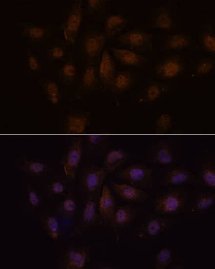 Immunocytochemistry/ Immunofluorescence: MED15 Antibody - Azide and BSA Free [NBP3-15565] - Immunofluorescence analysis of C6 cells using MED15 Rabbit pAb  at dilution of 1:100. Secondary antibody: Cy3 Goat Anti-Rabbit IgG (H+L)  at 1:500 dilution. Blue: DAPI for nuclear staining.