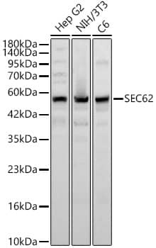 Western Blot: SEC62 Antibody - Azide and BSA Free [SEC62] - Western blot analysis of various lysates using SEC62 Rabbit pAb  at 1:1000 dilution. Secondary antibody: HRP-conjugated Goat anti-Rabbit IgG (H+L)  at 1:10000 dilution. Lysates / proteins: 25 ug per lane. Blocking buffer: 3 % nonfat dry milk in TBST. Detection: ECL Basic Kit . Exposure time: 45s.