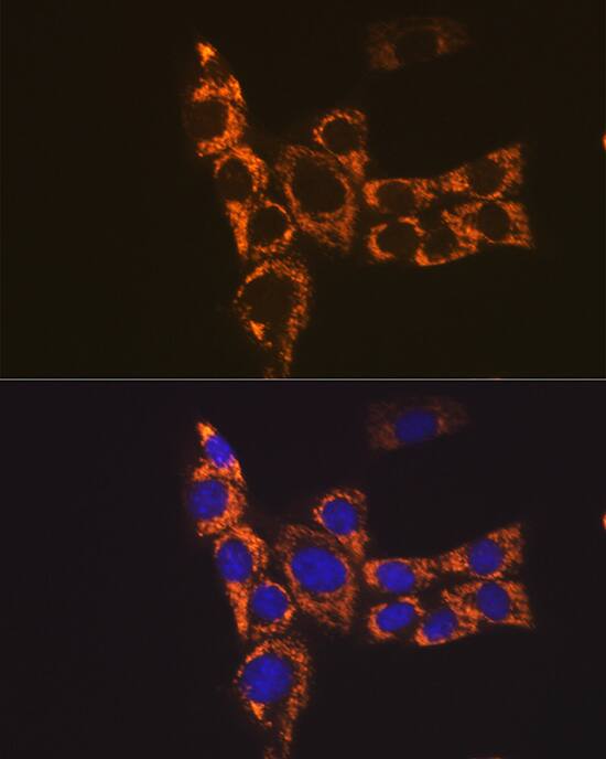 Immunocytochemistry/ Immunofluorescence: I-Ab Antibody - Azide and BSA Free [I-Ab] - Immunofluorescence analysis of NIH-3T3 cells using I-Ab Rabbit pAb  at dilution of 1:100 (40x lens). Secondary antibody: Cy3-conjugated Goat anti-Rabbit IgG (H+L)  at 1:500 dilution. Blue: DAPI for nuclear staining.