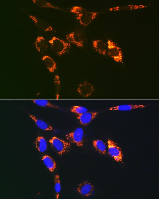 Immunocytochemistry/ Immunofluorescence: VAMP-7 Antibody - Azide and BSA Free [VAMP-7] - Immunofluorescence analysis of NIH/3T3 cells using VAMP-7 Rabbit pAb  at dilution of 1:100. Secondary antibody: Cy3-conjugated Goat anti-Rabbit IgG (H+L)  at 1:500 dilution. Blue: DAPI for nuclear staining.