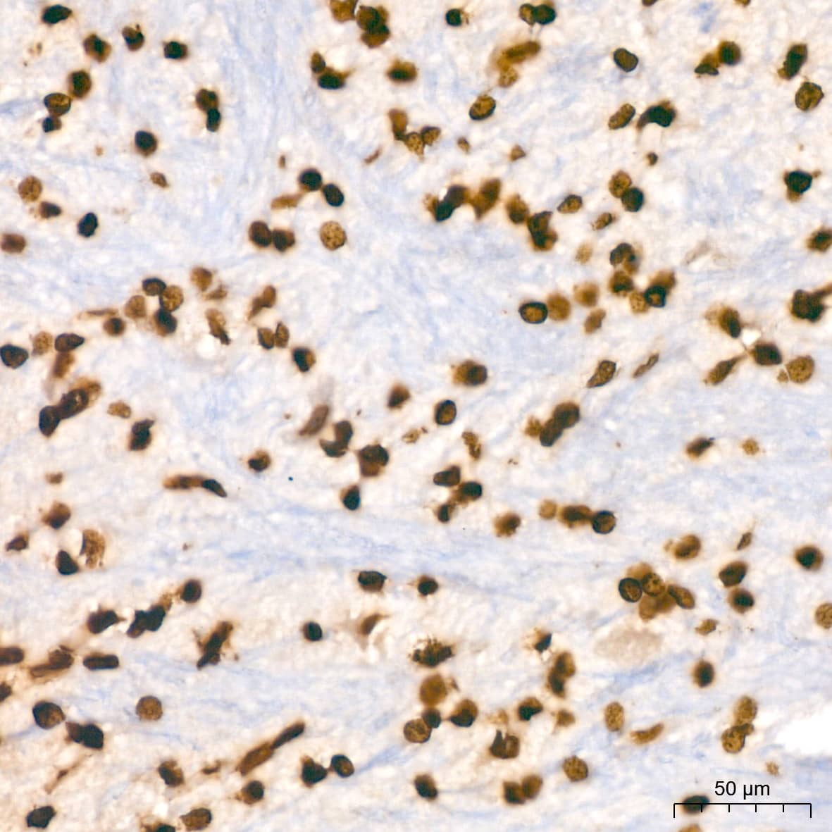 Immunohistochemistry: Histone H2B Antibody (3U2P5) [Histone H2B] - Immunohistochemistry analysis of paraffin-embedded Rat brain tissue using Histone H2B Rabbit mAb  at a dilution of 1:200 (40x lens). High pressure antigen retrieval performed with 0.01M Tris-EDTA Buffer (pH 9.0) prior to IHC staining.