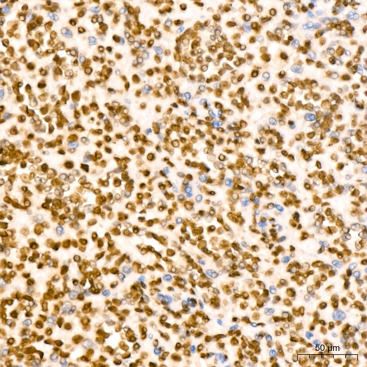 Immunohistochemistry: Histone H2B Antibody (3U2P5) [Histone H2B] - Immunohistochemistry analysis of paraffin-embedded Human spleen tissue using Histone H2B Rabbit mAb  at a dilution of 1:200 (40x lens). High pressure antigen retrieval performed with 0.01M Tris-EDTA Buffer (pH 9.0) prior to IHC staining.