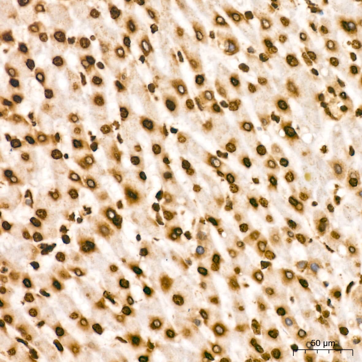 Immunohistochemistry: Histone H2B Antibody (3U2P5) [Histone H2B] - Immunohistochemistry analysis of paraffin-embedded Human liver tissue using Histone H2B Rabbit mAb  at a dilution of 1:200 (40x lens). High pressure antigen retrieval performed with 0.01M Tris-EDTA Buffer (pH 9.0) prior to IHC staining.