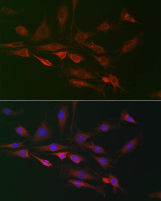Immunocytochemistry/ Immunofluorescence: RAI16 Antibody - Azide and BSA Free [RAI16] - Immunofluorescence analysis of C6 cells using RAI16 Rabbit pAb  at dilution of 1:100 (40x lens). Secondary antibody: Cy3-conjugated Goat anti-Rabbit IgG (H+L)  at 1:500 dilution. Blue: DAPI for nuclear staining.