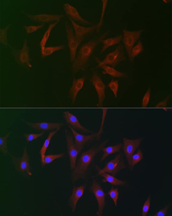 Immunocytochemistry/ Immunofluorescence: RAI16 Antibody - Azide and BSA Free [RAI16] - Immunofluorescence analysis of NIH/3T3 cells using RAI16 Rabbit pAb  at dilution of 1:100 (40x lens). Secondary antibody: Cy3-conjugated Goat anti-Rabbit IgG (H+L)  at 1:500 dilution. Blue: DAPI for nuclear staining.