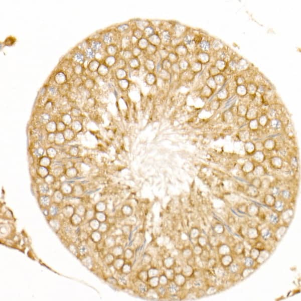 Immunohistochemistry: RAI16 Antibody - Azide and BSA Free [RAI16] - Immunohistochemistry analysis of paraffin-embedded Rat testis using RAI16 Rabbit pAb  at dilution of 1:100 (40x lens). High pressure antigen retrieval performed with 0.01M Citrate Bufferr (pH 6.0) prior to IHC staining.