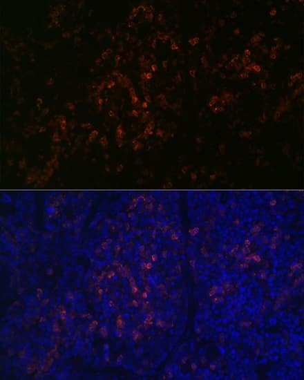 Immunocytochemistry/ Immunofluorescence: BTK Antibody (2J9O8) [BTK] - Immunofluorescence analysis of paraffin-embedded mouse spleen using BTK Rabbit mAb  at dilution of 1:100 (40x lens). Secondary antibody: Cy3-conjugated Goat anti-Rabbit IgG (H+L)  at 1:500 dilution. Blue: DAPI for nuclear staining.