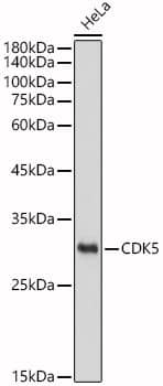 <b>Genetic Strategies Validation. </b>Western Blot: Cdk5 Antibody (7C8T10) [Cdk5] - Western blot analysis of lysates from Hela cells, using Cdk5 Rabbit mAb  at 1:1000 dilutionSecondary antibody: HRP Goat Anti-Rabbit IgG (H+L)  at 1:10000 dilution.Lysates/proteins: 25ug per lane.Blocking buffer: 3% nonfat dry milk in TBST.Detection: ECL Basic Kit .Exposure time: 1s.