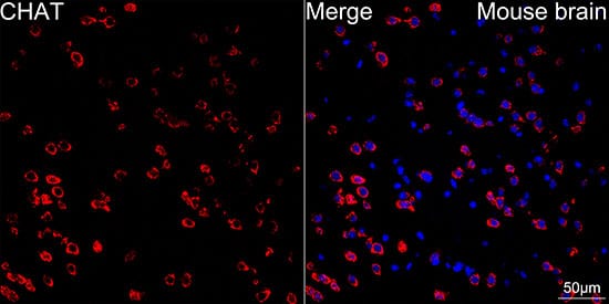 Immunocytochemistry/ Immunofluorescence: Choline Acetyltransferase/ChAT Antibody (1I4V0) [Choline Acetyltransferase/ChAT] - Confocal imaging of paraffin-embedded mouse brain using CHAT Rabbit mAb  followed by a further incubation with Cy3 Goat Anti-Rabbit IgG (H+L)  . DAPI was used for nuclear staining (Blue). Objective: 40x.